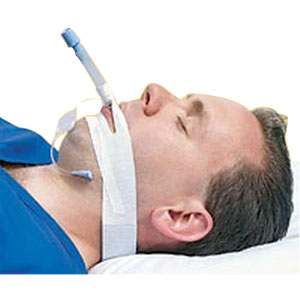 Trachtape, Endotracheal Tube Securing Device | LA Medical Wholesale